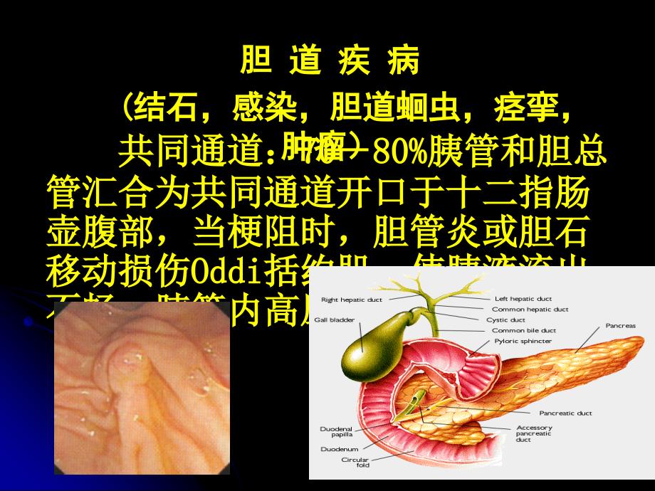 急性胰腺炎_第4页