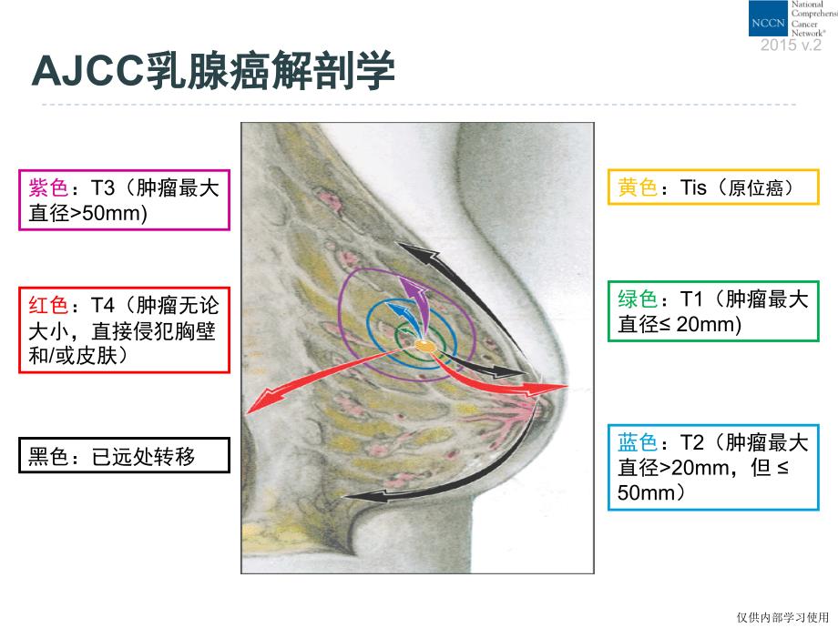 2015年乳腺癌nccn指南（中文版）.ppt_第4页