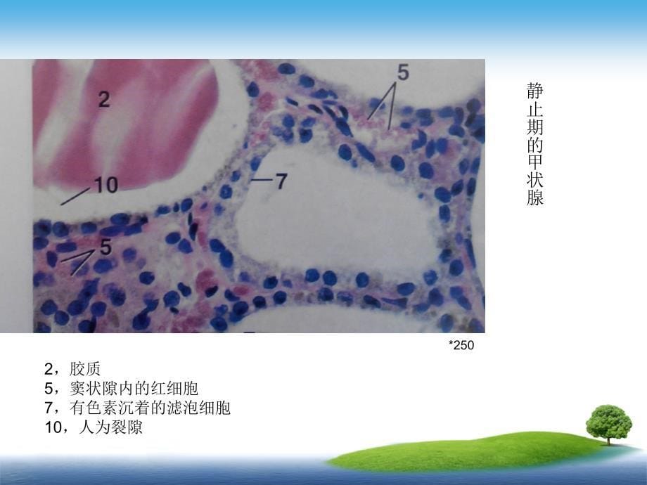 甲状腺与甲状旁腺(组织胚胎学)_第5页