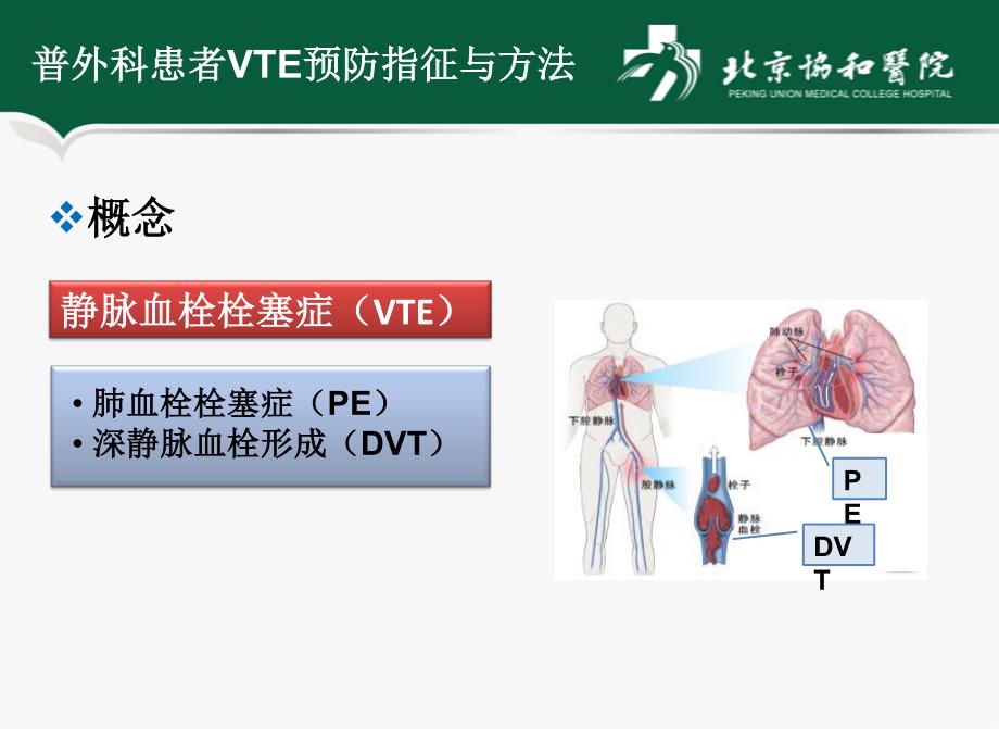 普外科患者vte预防指征与方法-北京协和医院_第2页