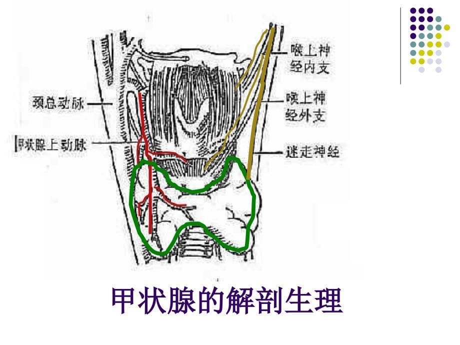 甲状腺癌教学查房.ppt_第5页