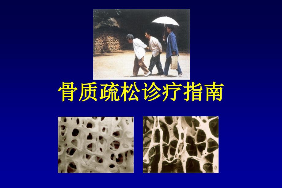 原发性骨质疏松症诊治指南.ppt_第1页