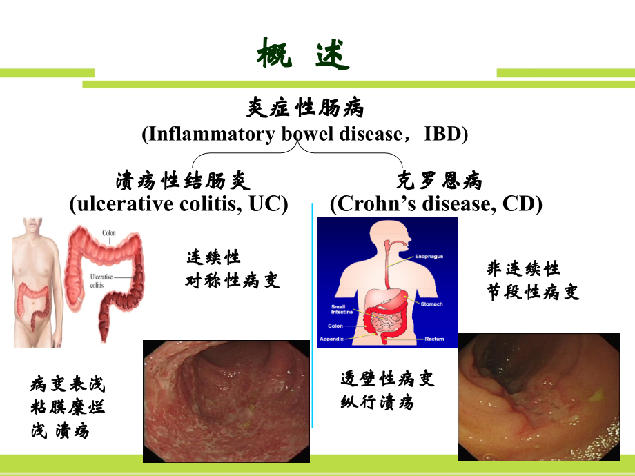 内科学进展ppt-张红杰.ppt_第2页