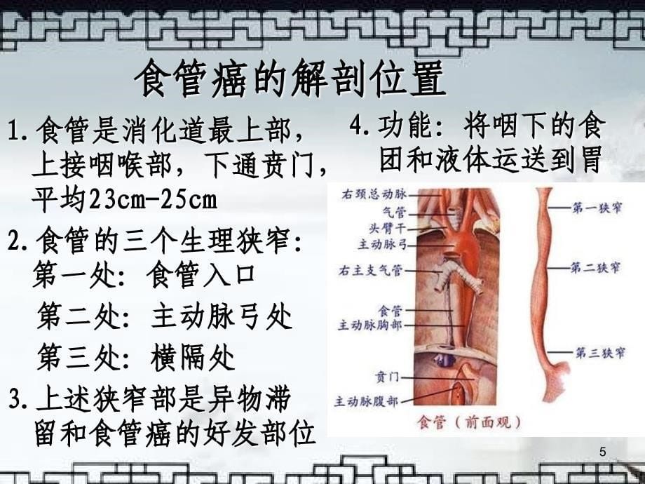 食管癌的护理.ppt_第5页