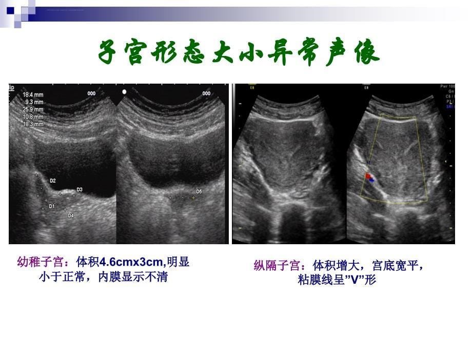 妇科超声常规检查风险评估---6(2).ppt_第5页