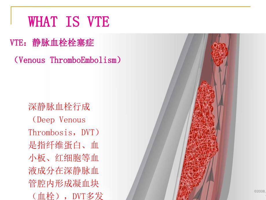 关节置换术后的防栓与治凝.ppt_第2页