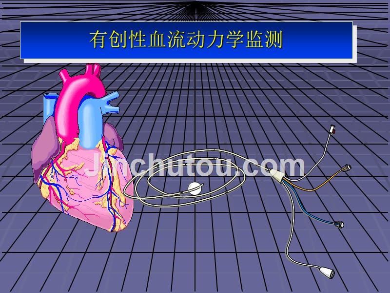 冠脉搭桥手术围术期监测与管理_第4页