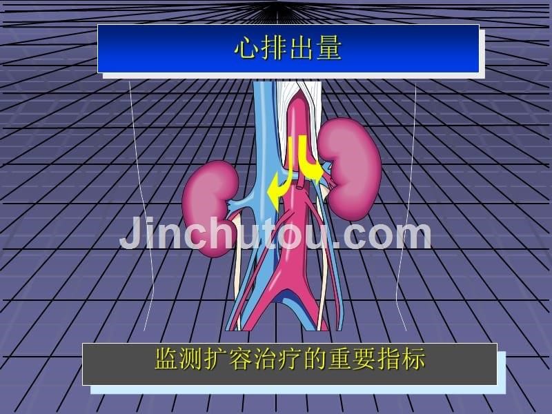 冠脉搭桥手术围术期监测与管理_第5页