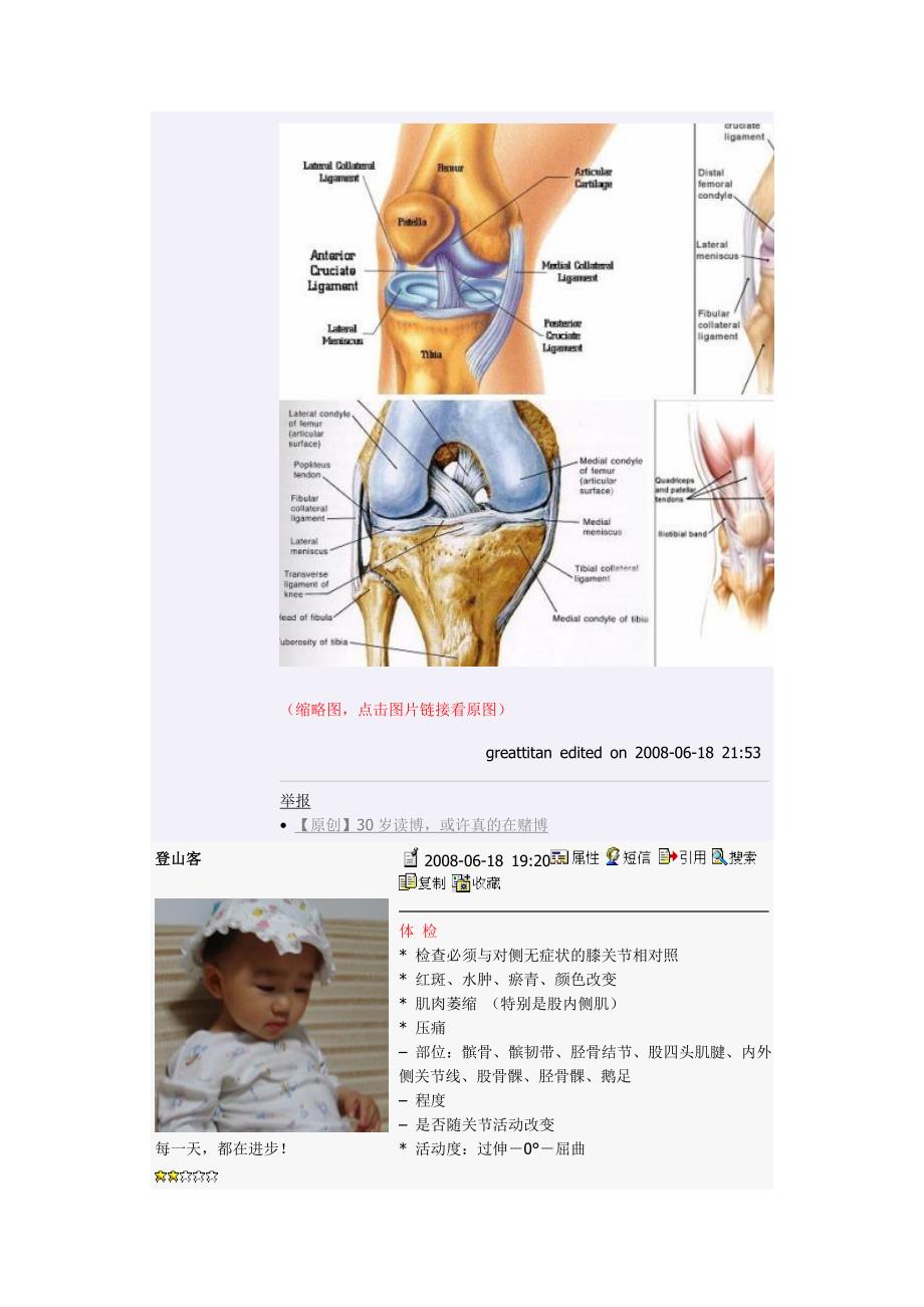 专题讲座膝关节疼痛的诊断与鉴别诊断_第2页