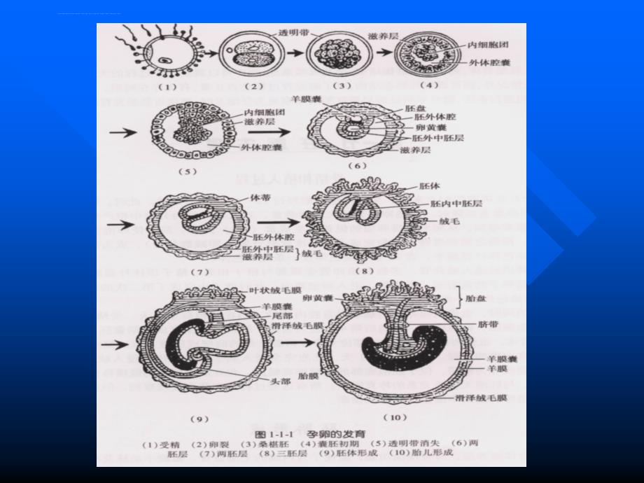 产科超声显像.ppt_第4页