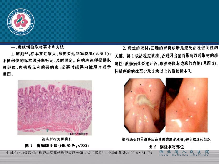 消化内镜病检.ppt_第3页