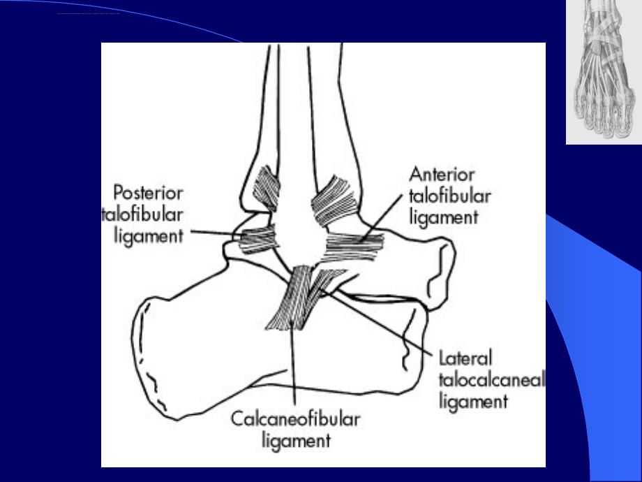 踝关节外侧韧带损伤.ppt_第3页