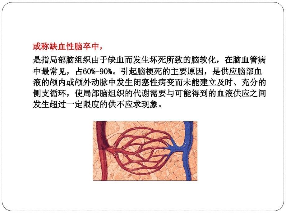 脑梗死护理查房提问.ppt_第5页