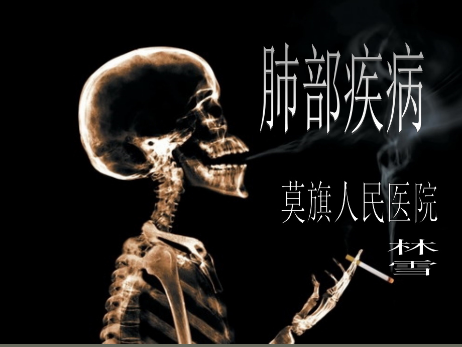 肺部疾病的x诊断_2.ppt_第1页