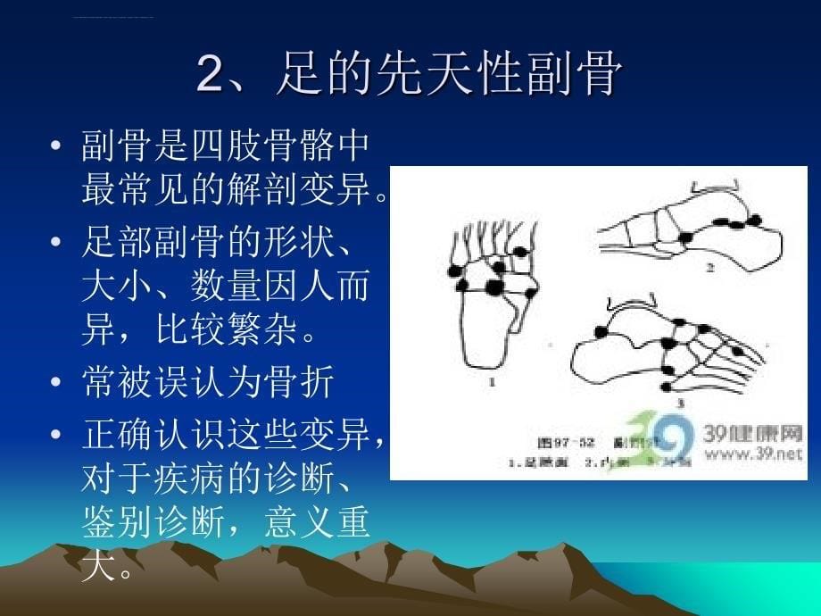 足踝部x线检查.ppt_第5页