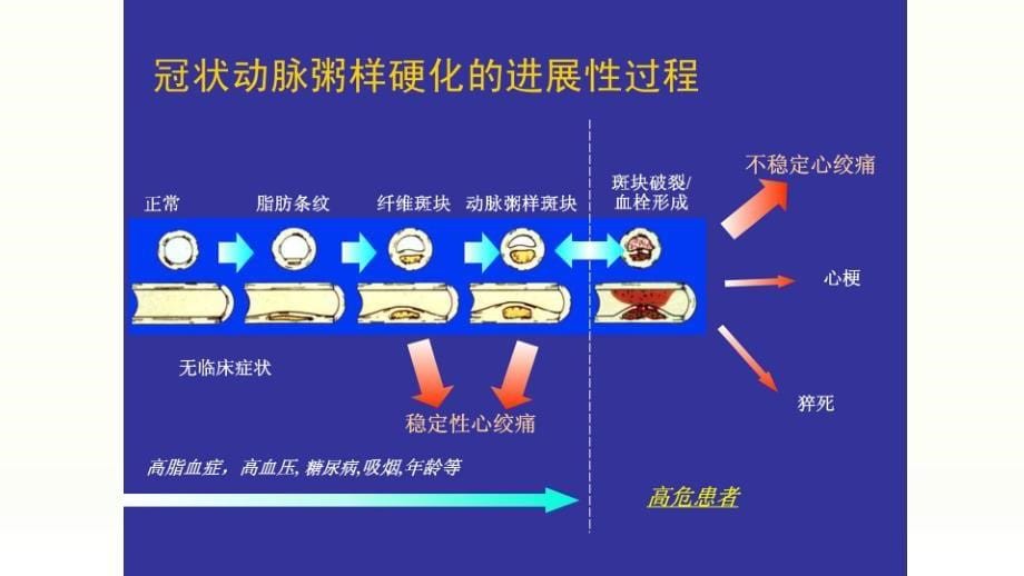 中医药养生保健治疗冠心病资料_第5页