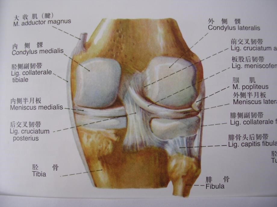 膝关节滑膜病mri_第5页