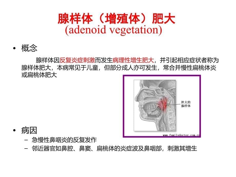 咽喉部的急慢性炎症资料_第5页