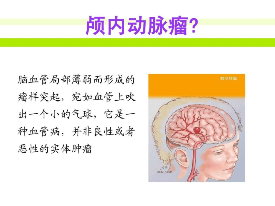 动脉瘤临床表现和治理_第2页