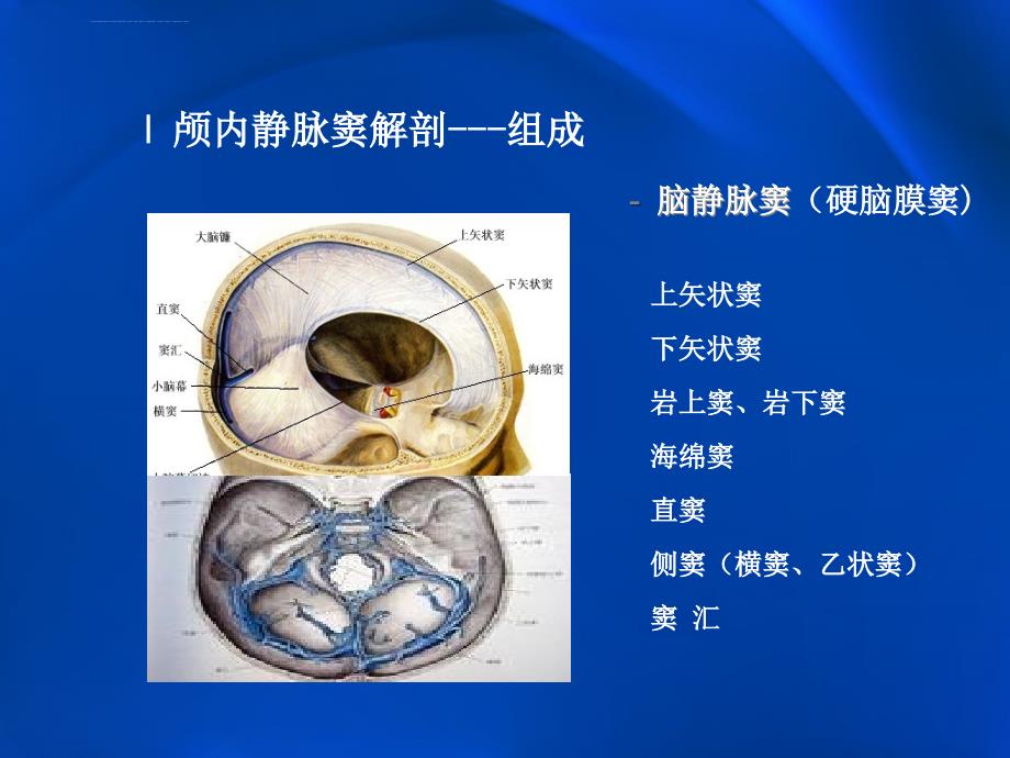 颅内静脉窦血栓形成的影像学表现.ppt_第3页