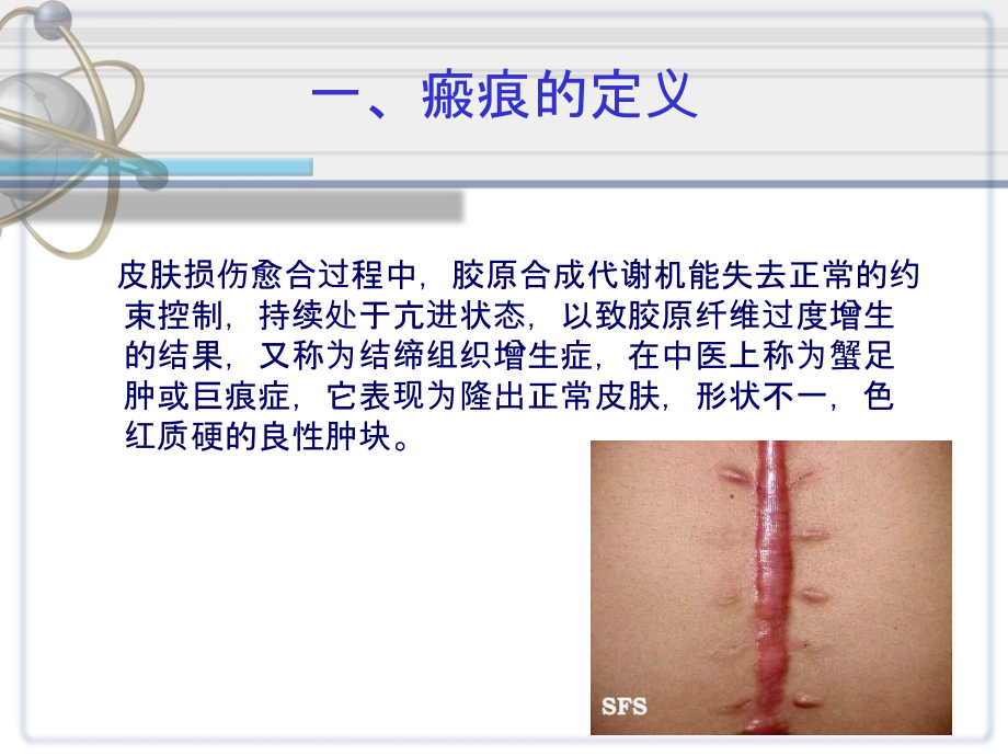 瘢痕与瘢痕疙瘩的综合治疗.ppt_第3页