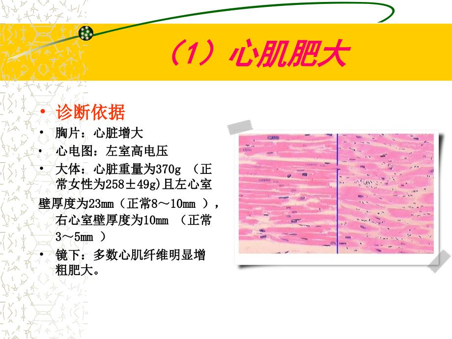 炎症病例讨论1..ppt_第4页