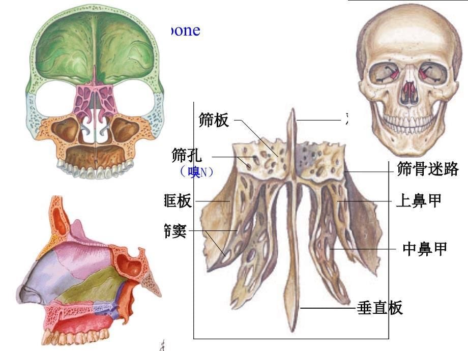 《人体解剖学》--颅骨.ppt_第5页