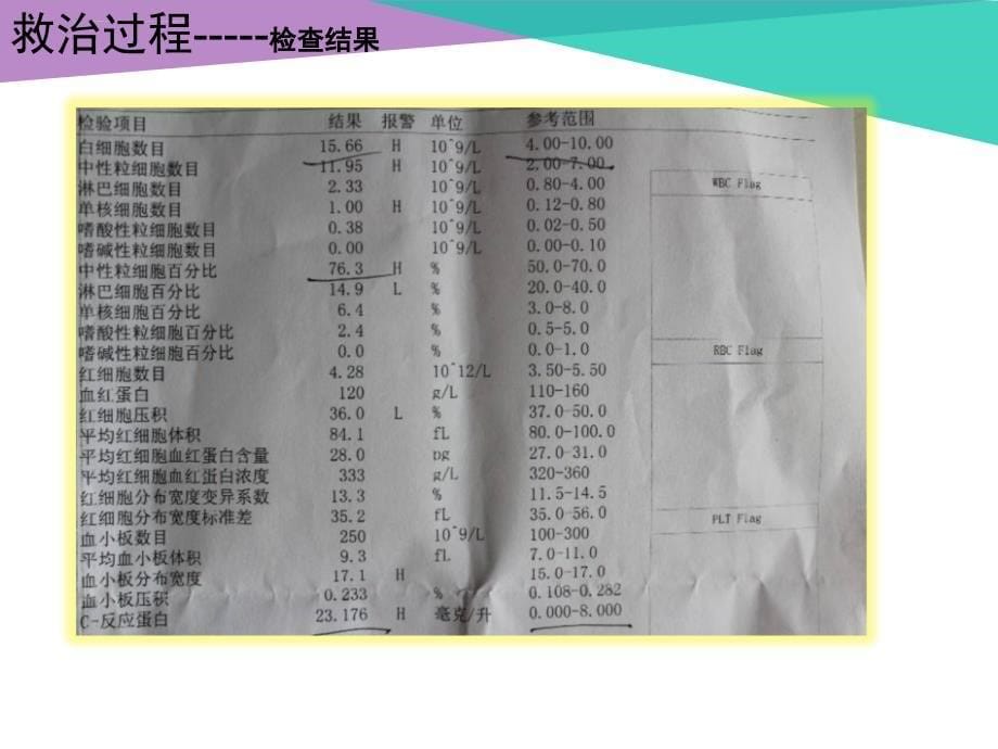 一例小儿护理惊厥护理查房.ppt_第5页