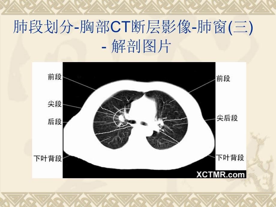 全身ct断层解剖详细实用图解.ppt_第5页