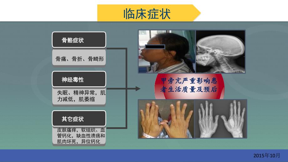 甲状旁腺微波消融科学应用_第3页