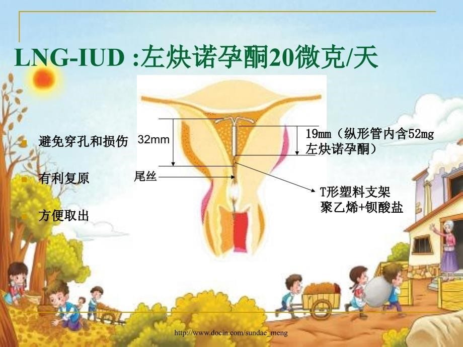 左炔诺孕酮宫内释放系统临床科学应用_第5页