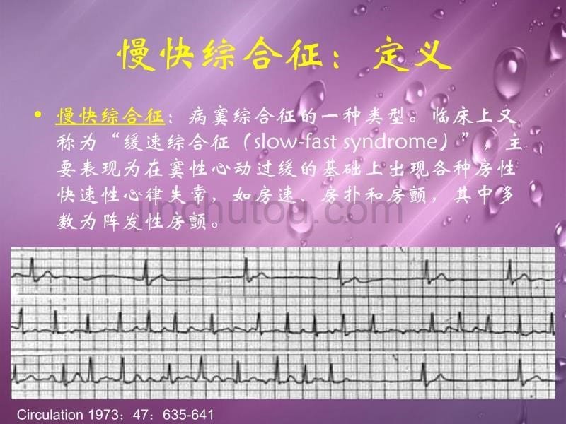 慢快综合征vs快慢综合征有效治疗策略选择_第5页