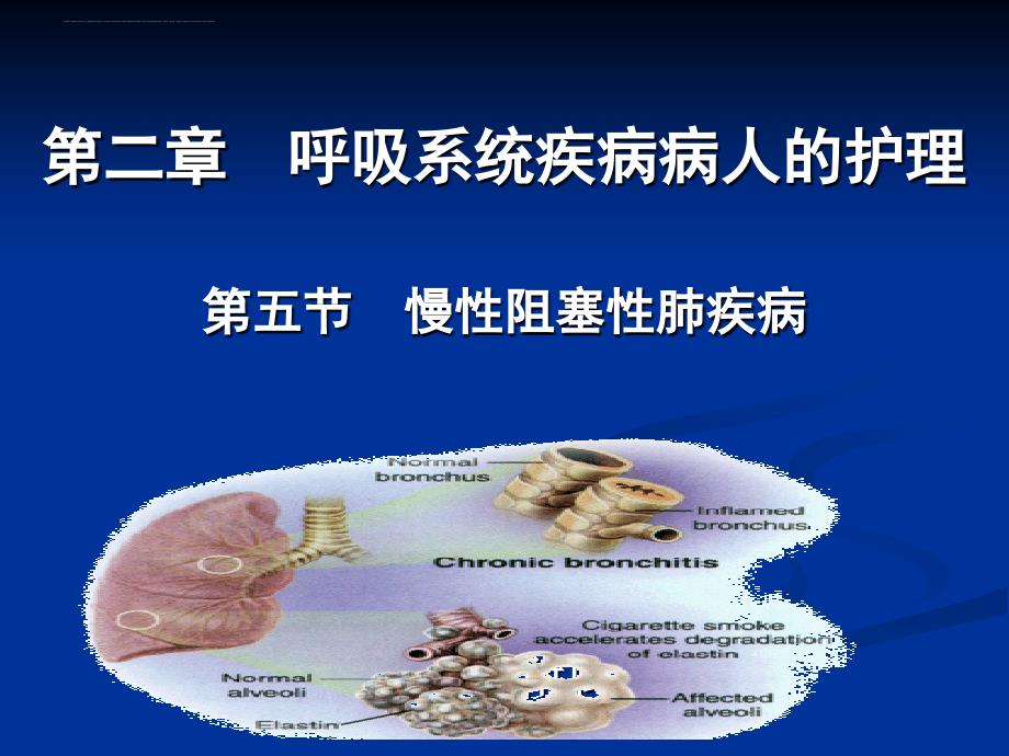 第二章-第5节-2慢性阻塞性肺疾病.ppt_第1页