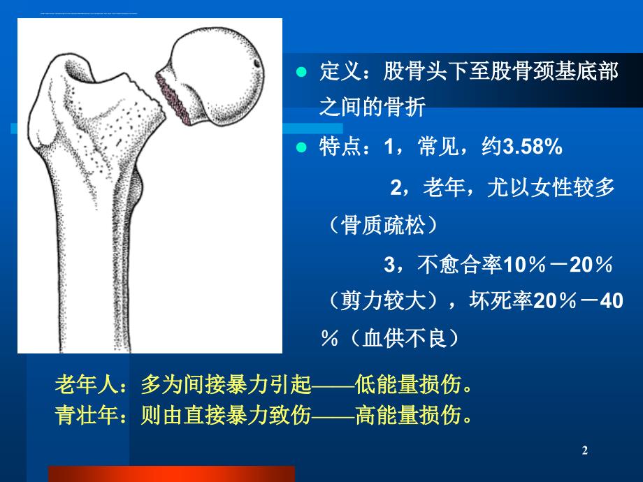 股骨颈骨折ppt精品课件（1）.ppt_第2页