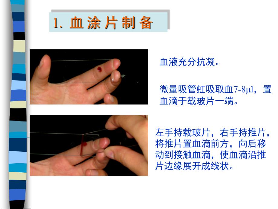 血涂片制备染色及白细胞形态(zcg)概要_第4页