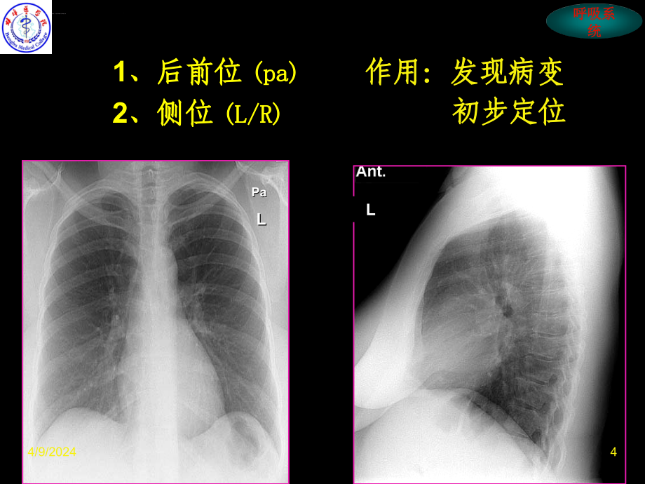 呼吸系统cai（临床专业）.ppt_第4页