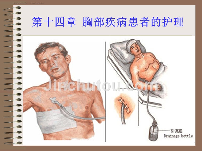 胸部疾病病人的护理课件.ppt_第1页