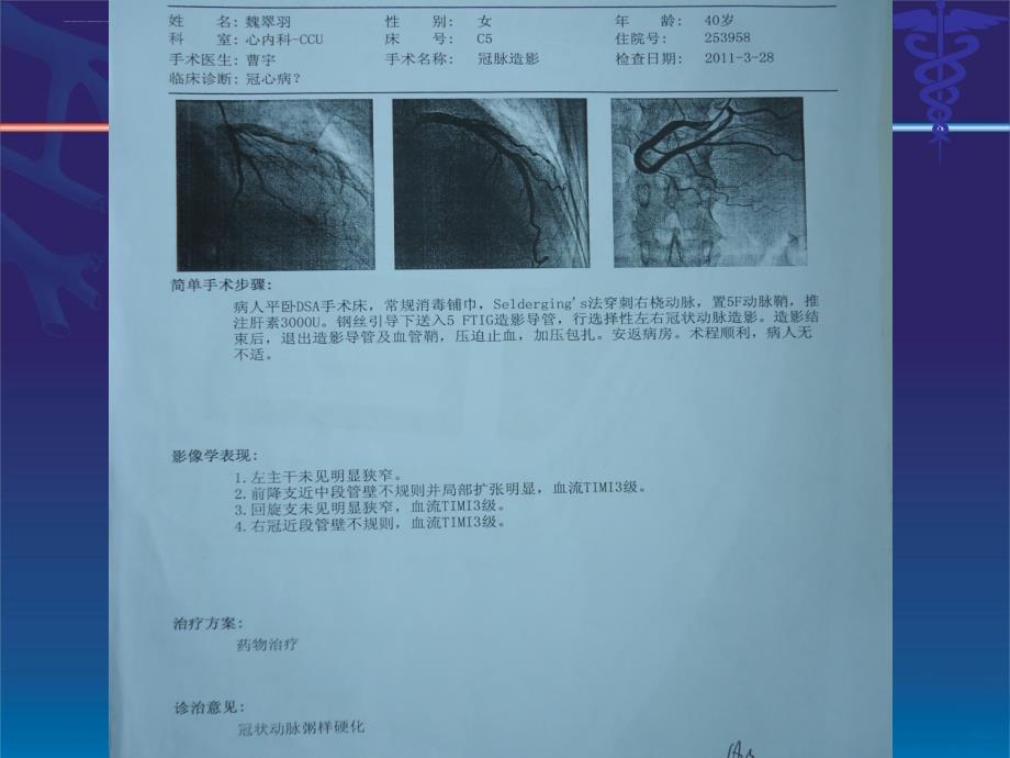 心血管内科-胸痛.ppt_第4页