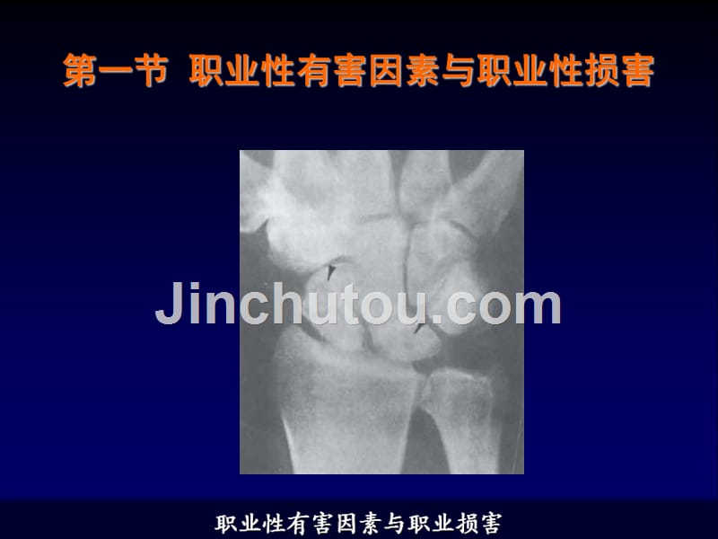 职业性有害因素与职业危害_第4页