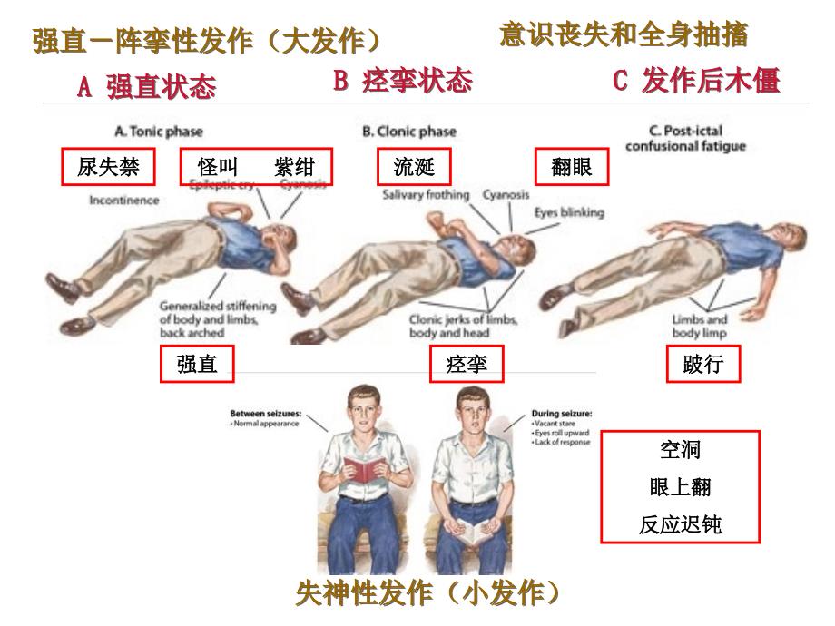 抗癫痫药抗帕金森药.ppt_第3页