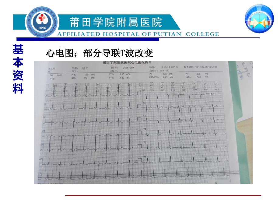 罕见纵隔肿瘤合并异位acth综合征1例 .ppt_第4页