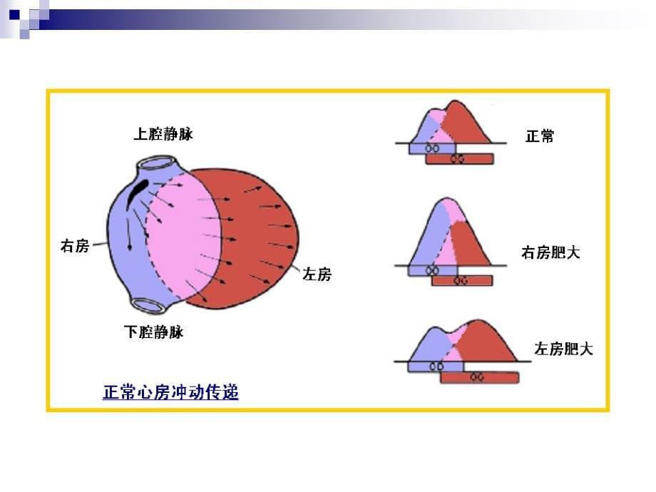 心电图第三~五节_第5页