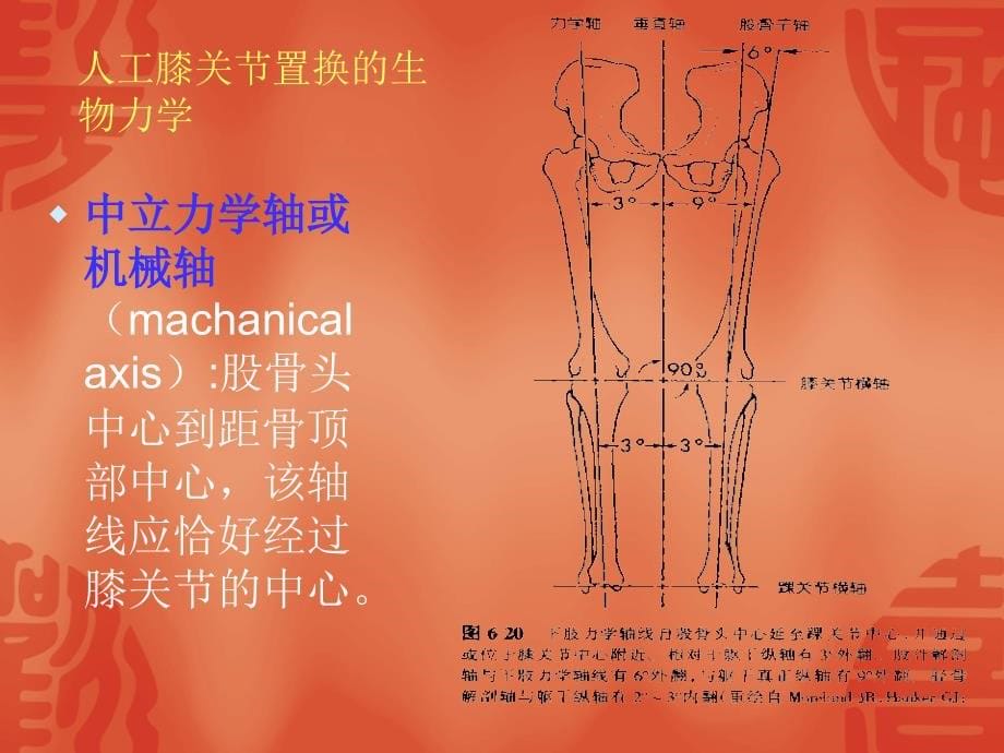 膝关节表面置换术汇编_第5页