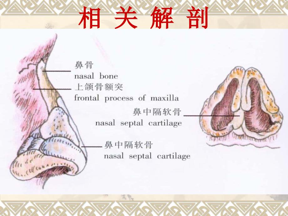 鼻骨骨折的治疗方法_第3页