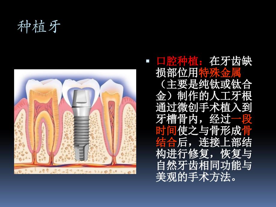 口腔专业知识培训.ppt_第2页