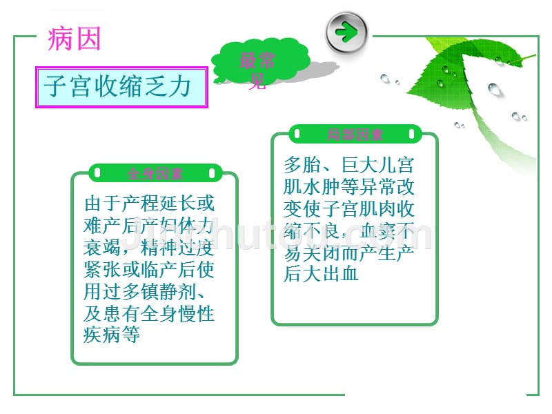 产后出血抢救和护理.ppt_第5页