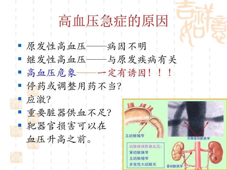 高血压治疗及危重症抢救.ppt_第5页