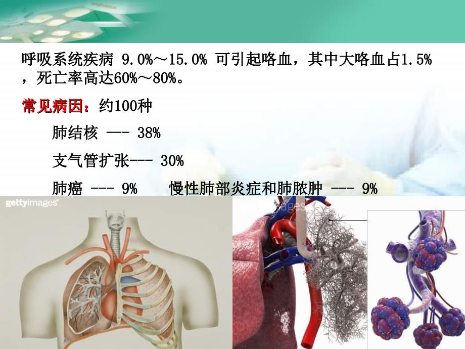 咯血介入治疗.ppt_第2页