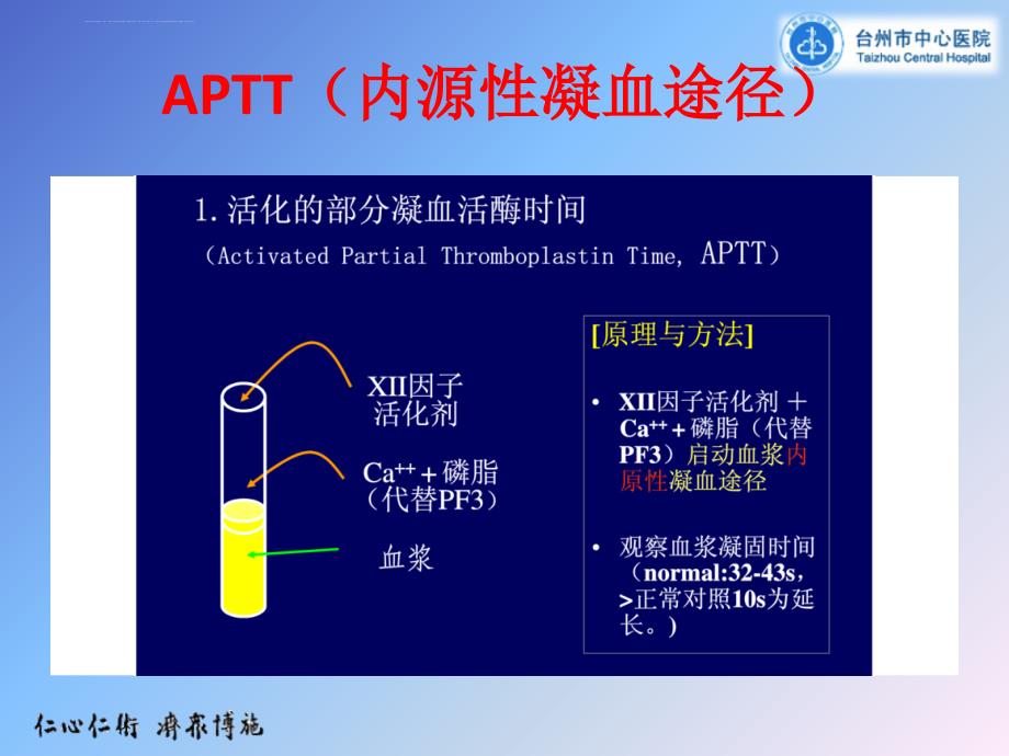 常见凝血功能异常的临床思维-新.ppt_第4页