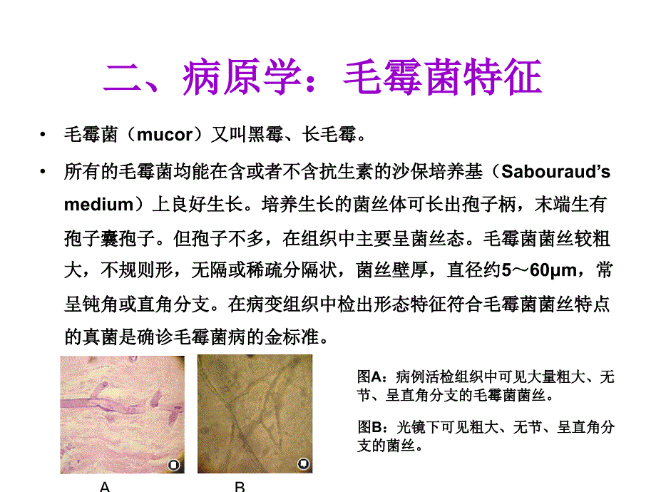 毛霉菌感染的临床特征与治疗.ppt_第4页